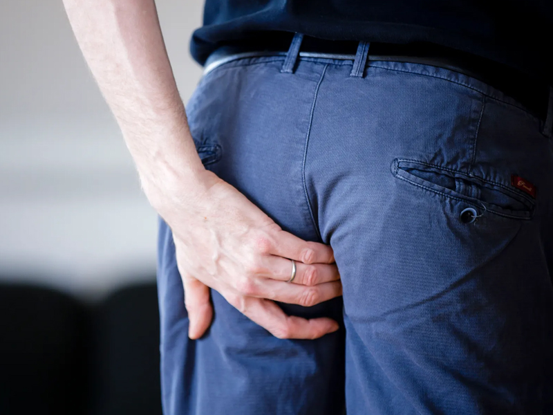 屁屁縫隙裡的毛能脫嗎？