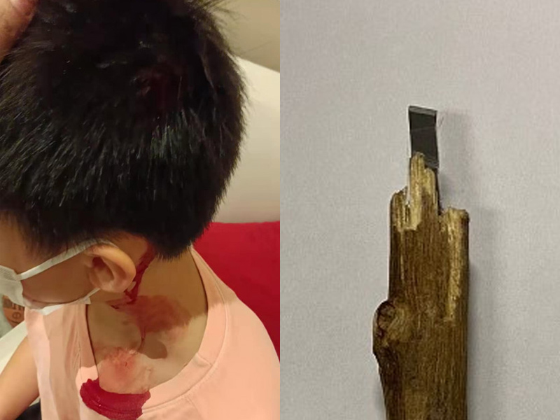 刀片插傷男童頭 9歲男童被帶署調查