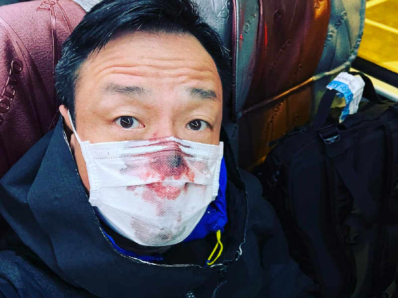 香港明星王喜 陽性仍帶著染血口罩 在台拍片打卡 香港明星王喜 陽性仍帶著染血口罩 在台拍片打卡