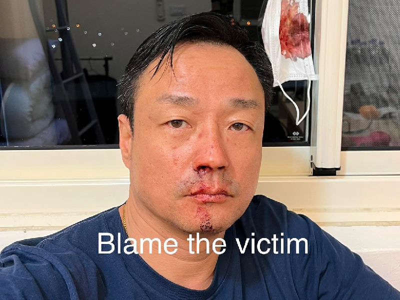 香港明星王喜 嘲諷台檢測差 香港人被批不尊重人 香港明星王喜 嘲諷台檢測差 香港人被批不尊重人