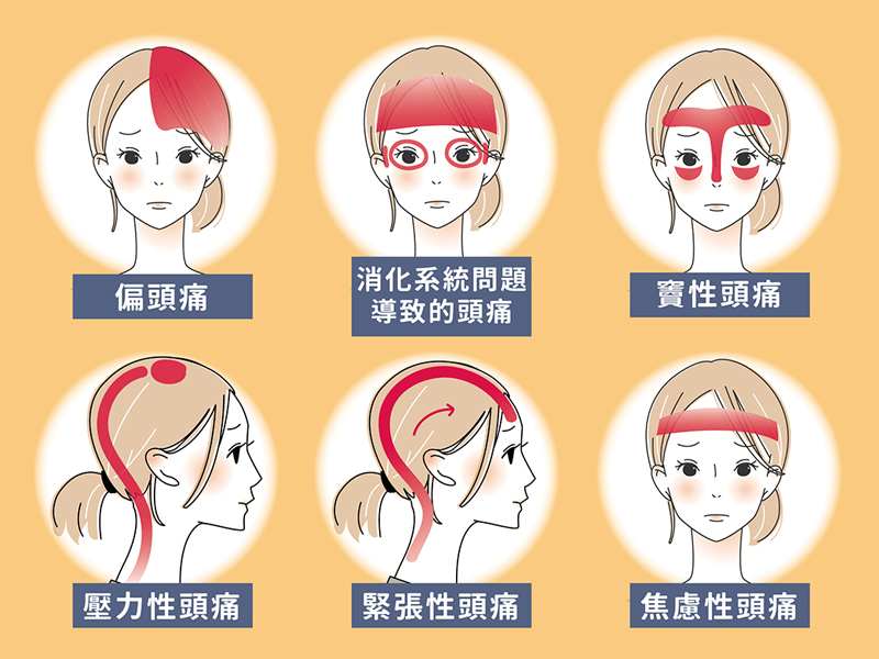 頭痛有很多種，你的屬於哪一種？