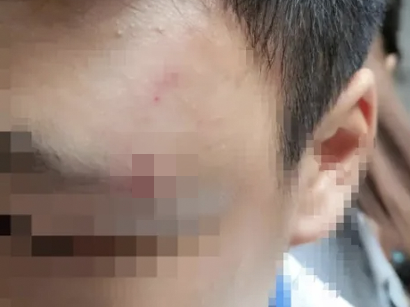 老師學生發生爭執，老師流產，學生被老師丈夫刺眼