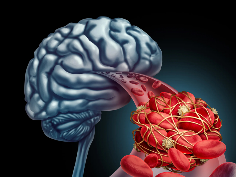 研究發現：睡覺的時候，淋巴會清除腦中毒素