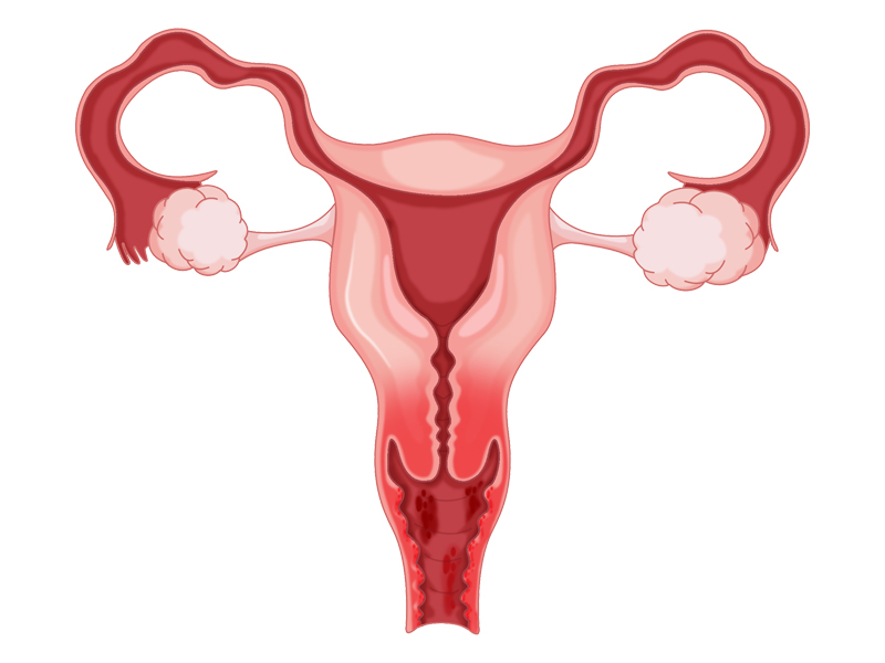 人造子宮真的要來了嗎？