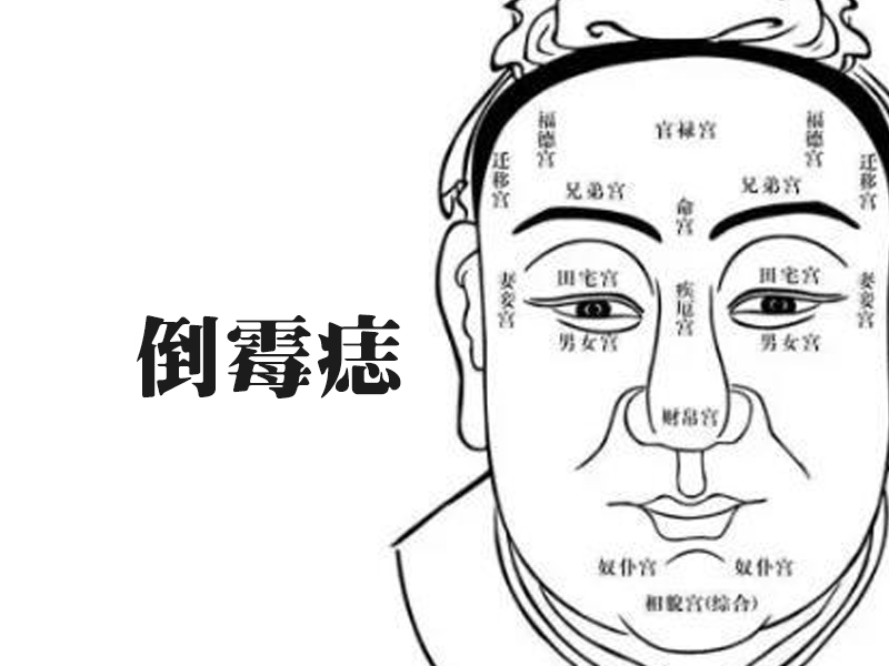 四種倒霉痣，破財漏財感情不順，晚年孤獨無依