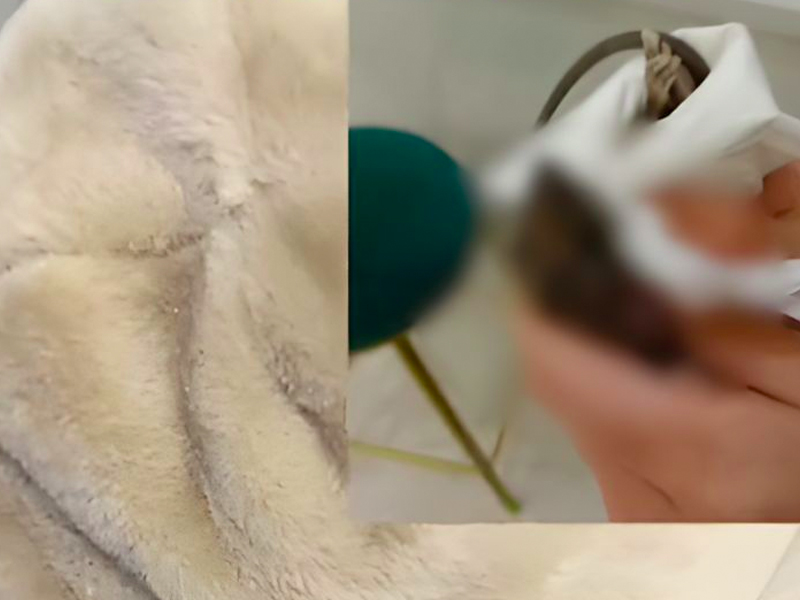 女生被老鼠咬手後，竟反咬一口老鼠