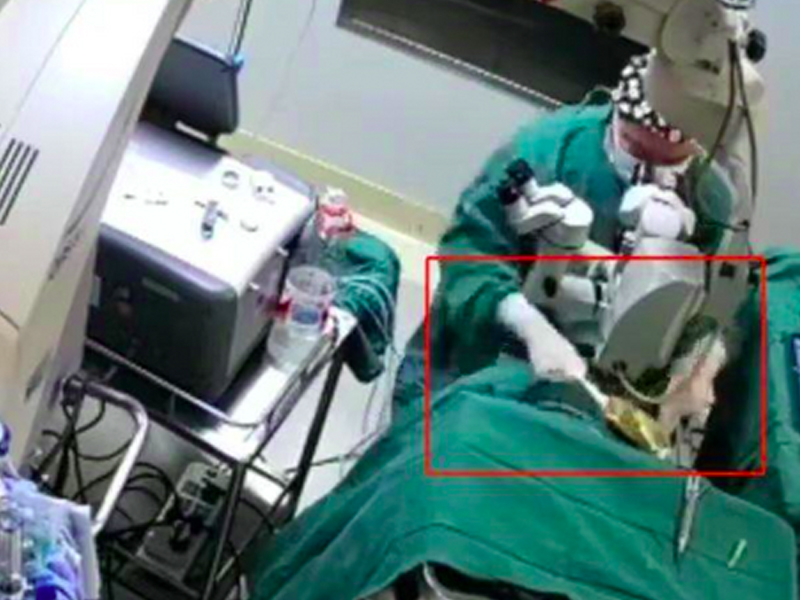 醫生在手術期間，多次拳打 82 歲女病患