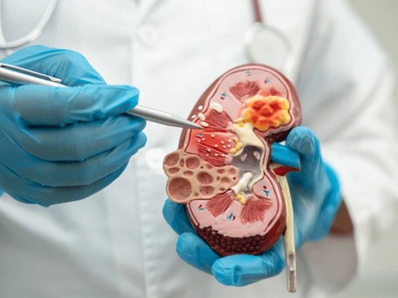 吃這些早餐都在毀腎!10 大毀腎食物 吃這些早餐都在毀腎!10 大毀腎食物