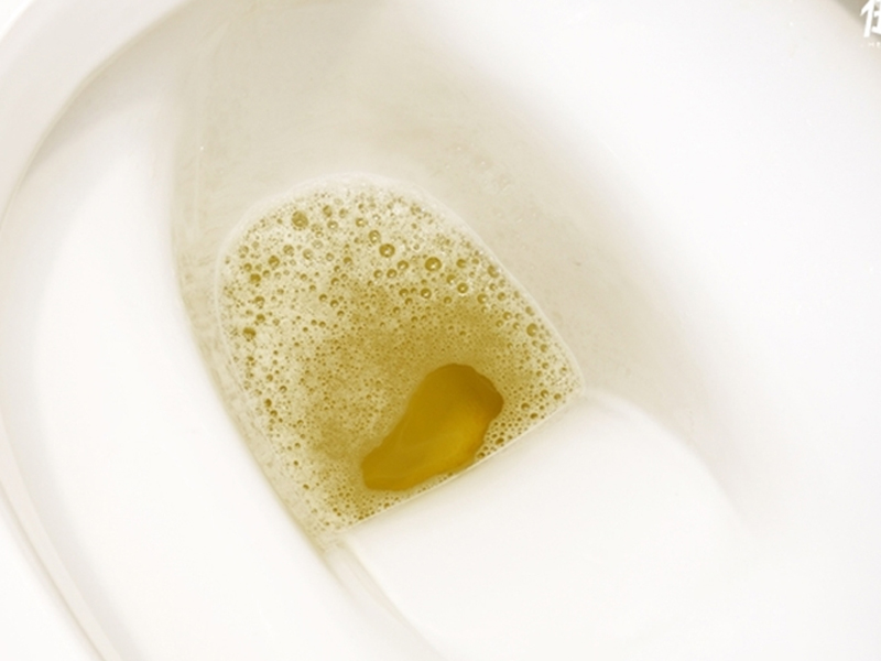 尿液里總是有泡沫，腎臟出問題了嗎？