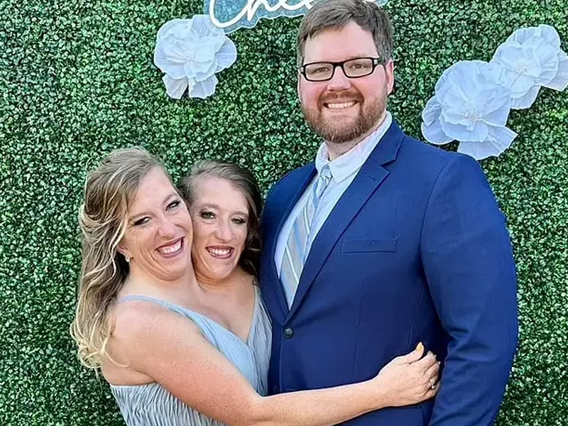 兩頭共用下半身，連體雙胞胎結婚