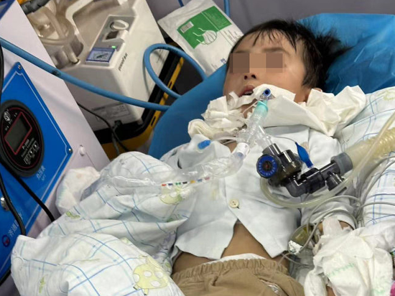3 歲男童被狗咬 18 天後身亡