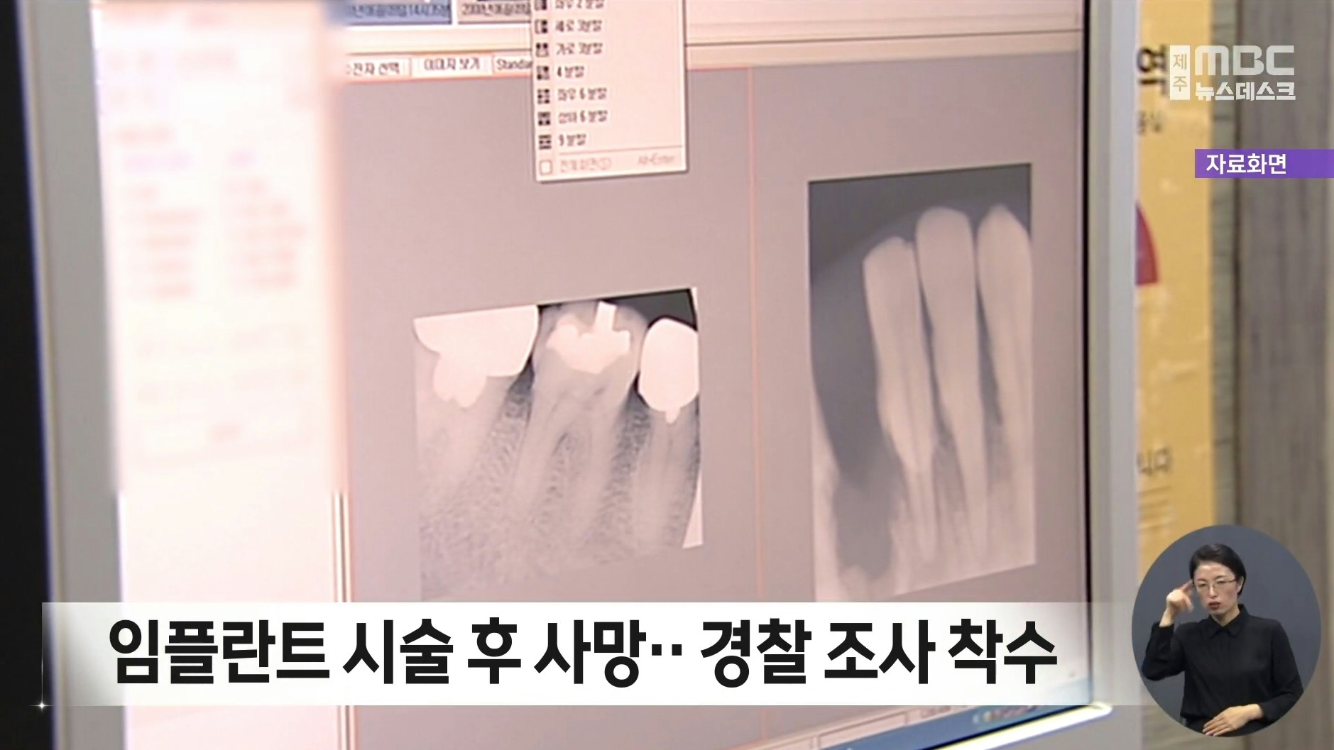 61 歲中國男子，韓國種牙後吐血身亡