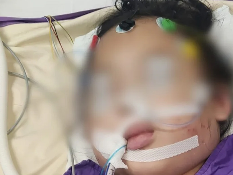 父親控仁濟醫院失職，4 歲女童縫針後心臟停頓、陷入昏迷