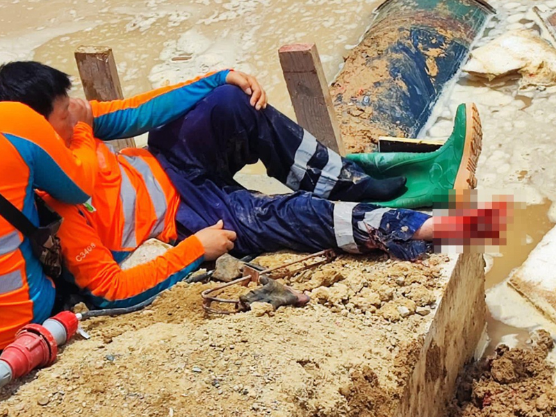 超恐怖工業意外：54歲工人右腳被壓斷，白骨外露