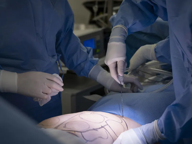 男子健康檢查後被變性，醒來竟被迫結婚！