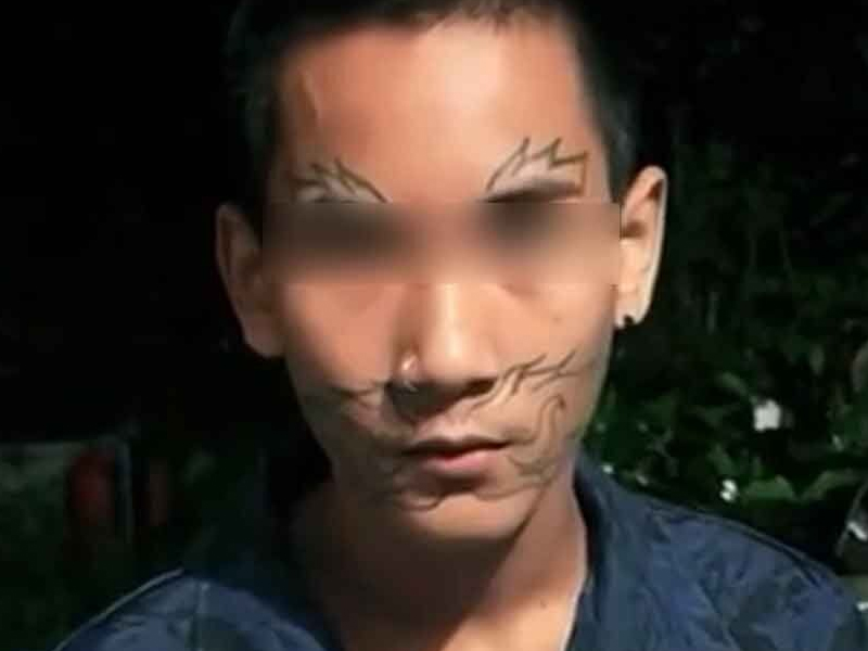 朋友慫恿之下，少年在面上紋身，結果後悔了