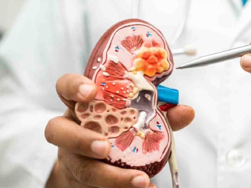 腎功能衰退的十大徵兆，這些你一定要知道！