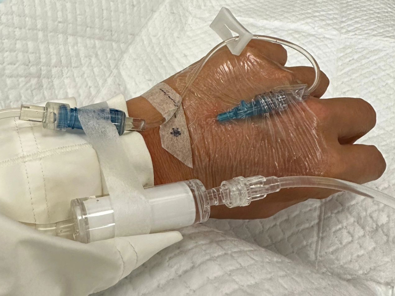 吳文忻,乳癌復發擴散至淋巴 吳文忻,乳癌復發擴散至淋巴