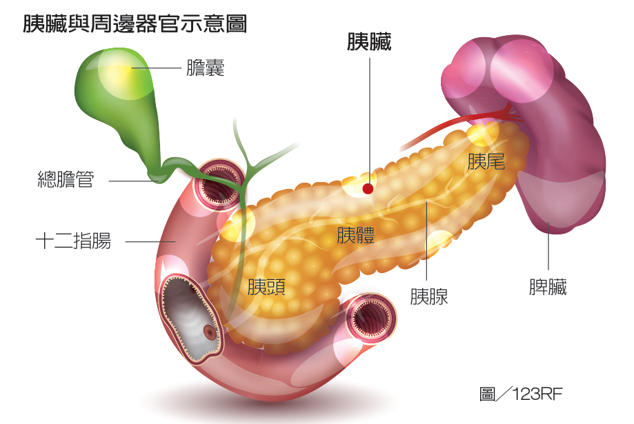 婦人全身瘙癢，竟是胰臟癌晚期警號