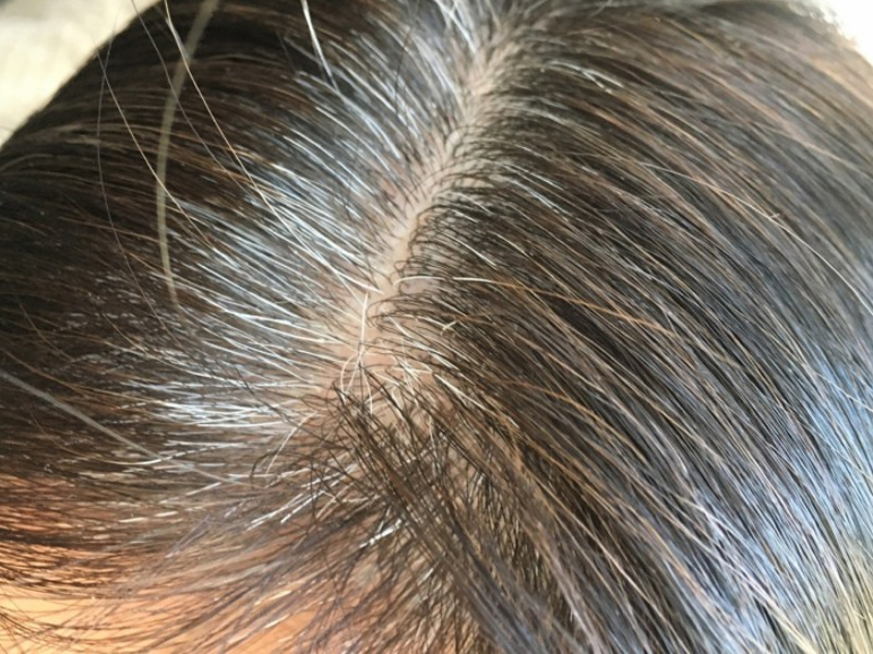 防白髮吃什麼?中醫推薦 5 大烏髮聖品 防白髮吃什麼?中醫推薦 5 大烏髮聖品