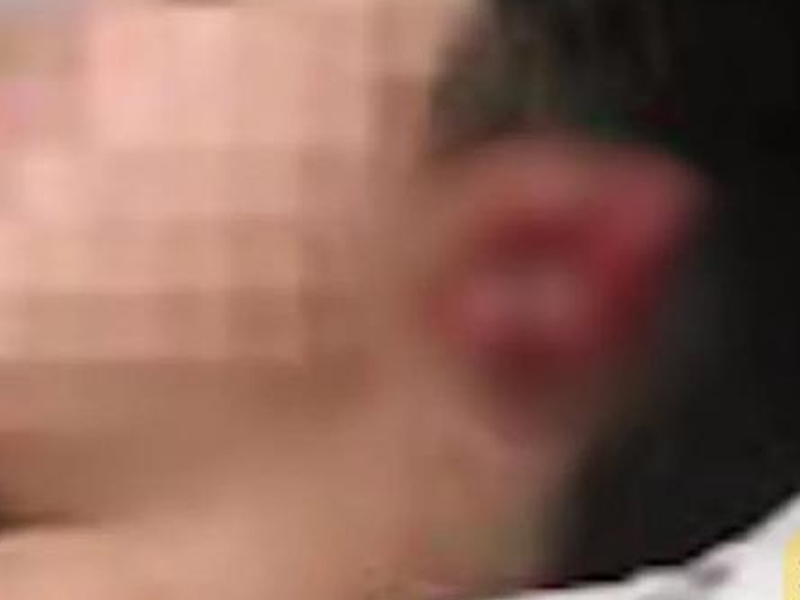 教師酒後咬傷學生耳朵事件