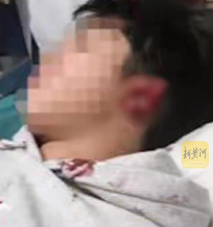 教師酒後咬傷學生耳朵事件