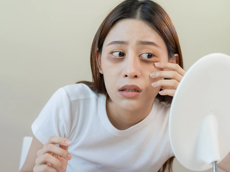 臉上 3 種異常,揭示肝功能問題嚴重 臉上 3 種異常,揭示肝功能問題嚴重