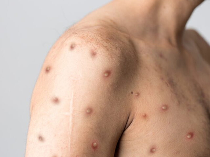 中國發生聚集性疫情，4 人接觸後感染！