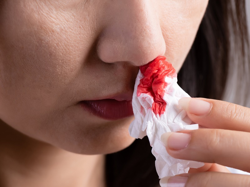 男子鼻出血不止,原是這些習慣惹的禍 男子鼻出血不止,原是這些習慣惹的禍