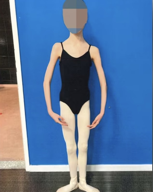 17 歲女營養不良，體重只有 27 kg