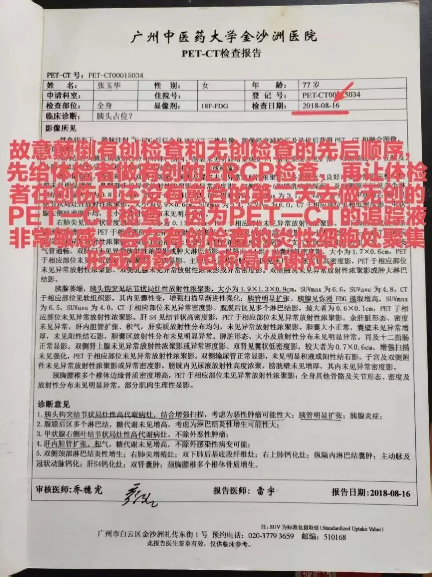 老人被誤診患癌，切除 5 器官後離世