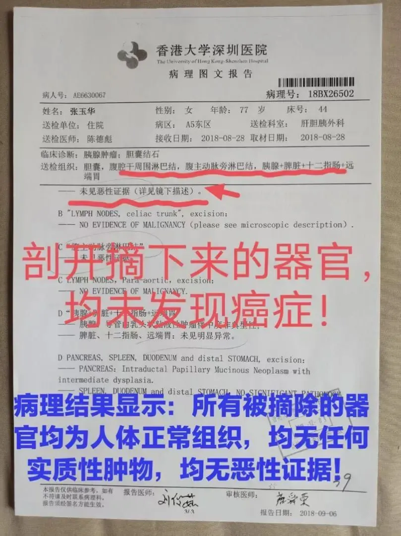 老人被誤診患癌，切除 5 器官後離世