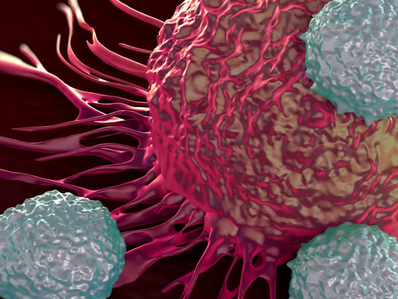 香港五大癌症 肺癌最常見