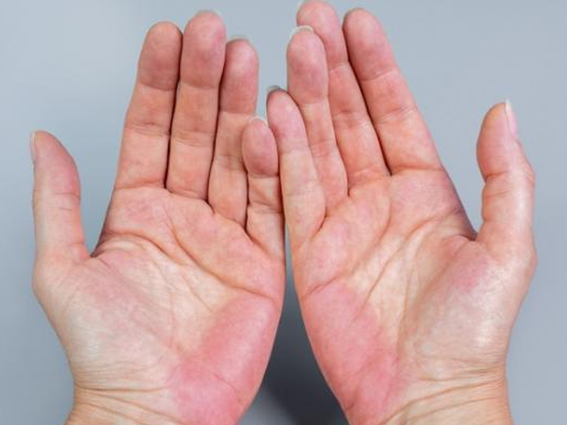 肝臟有癌,雙手先知 肝臟有癌,雙手先知