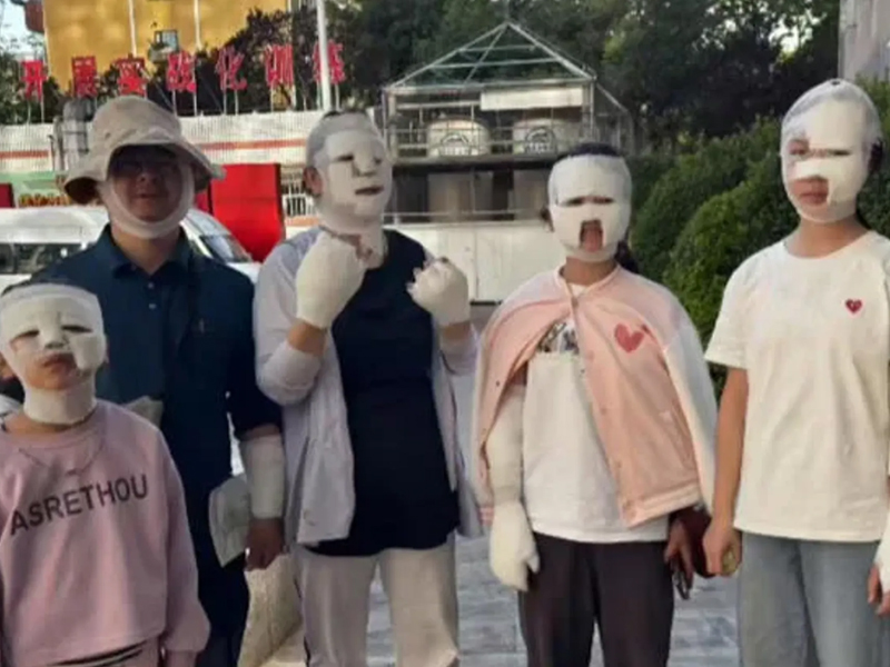 卡式燒烤爐爆炸，全家炸成木乃伊