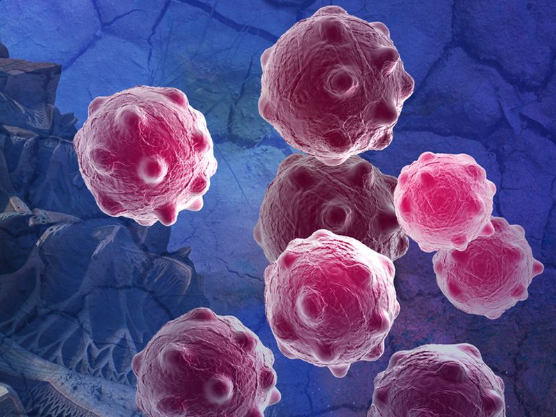 以為是濕疹，後來確診是乳腺癌