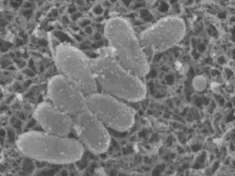 日本爆發 3 萬人感染