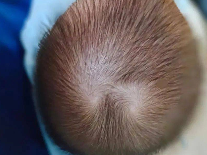 兩個髮旋真的更聰明嗎? 兩個髮旋真的更聰明嗎?