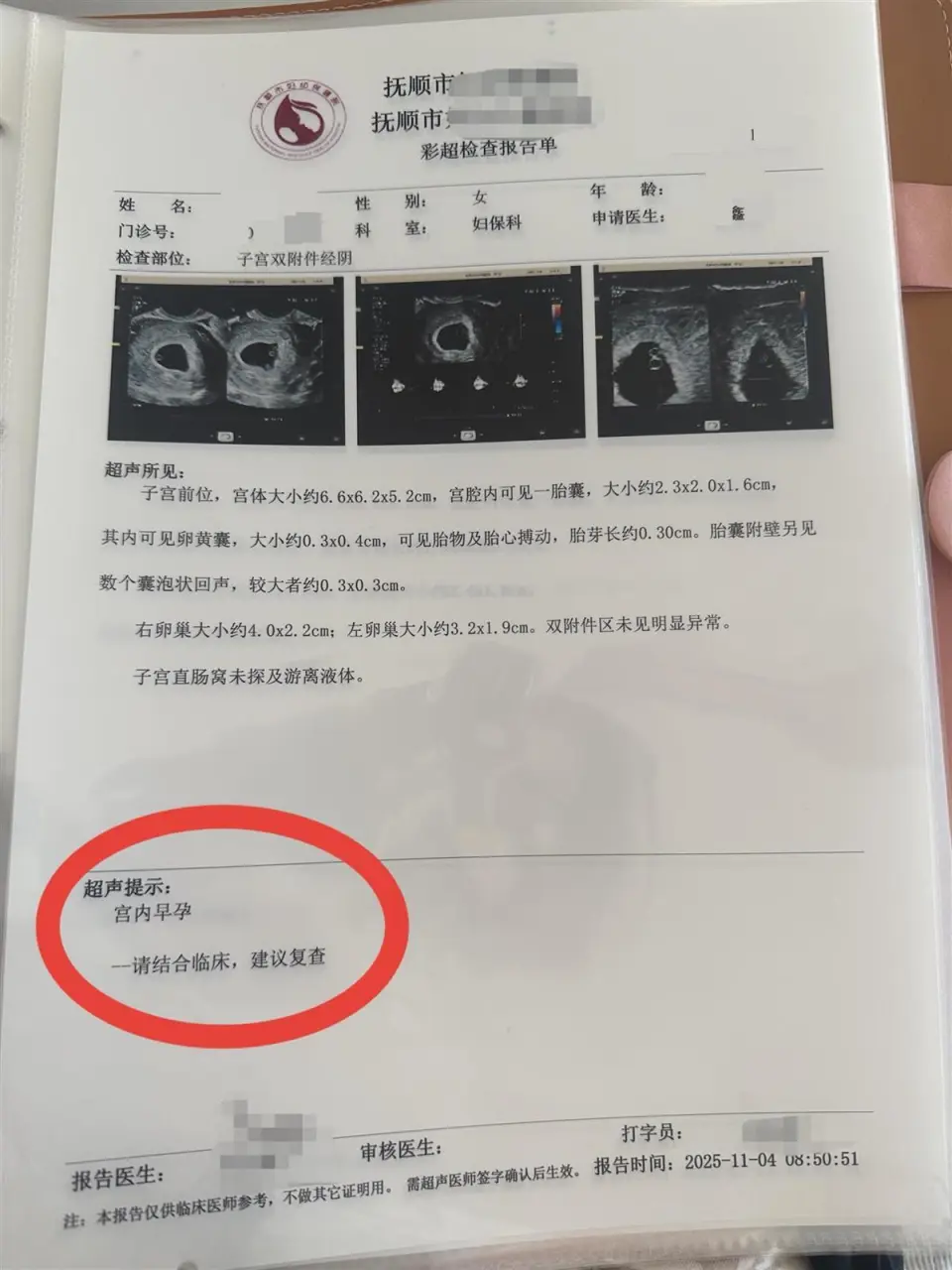 孕婦一胎變四胞胎，每次產檢多一胎