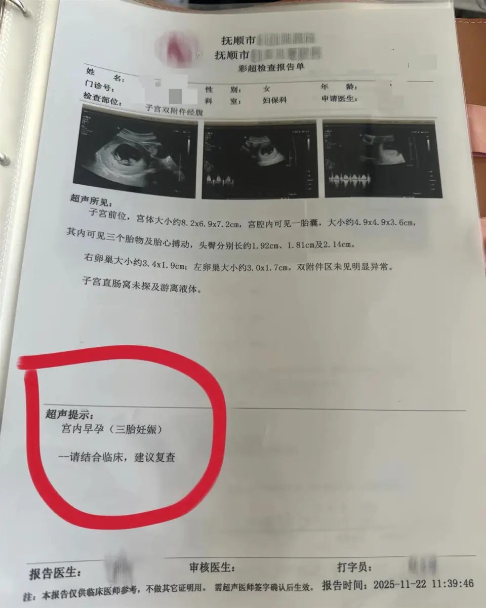 孕婦一胎變四胞胎，每次產檢多一胎