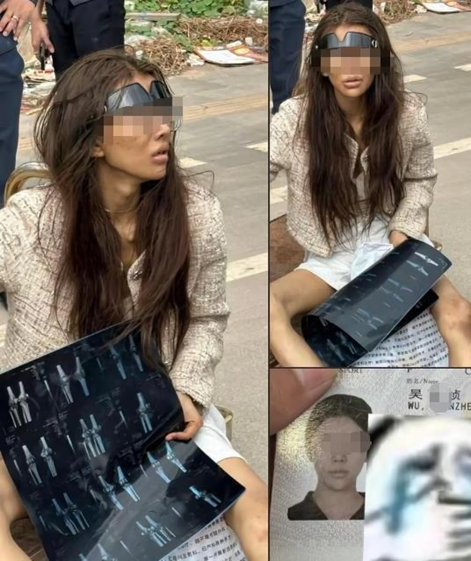 女網紅被男友賣柬埔寨 如今雙腿骨折流浪街頭